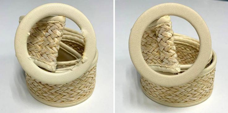 До и после: Перетяжка кожи