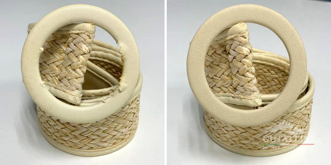 До и после: Перетяжка кожи